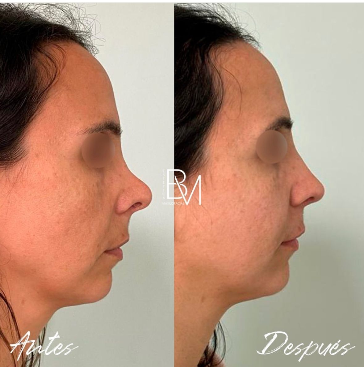 Beatriz Moralejo-45