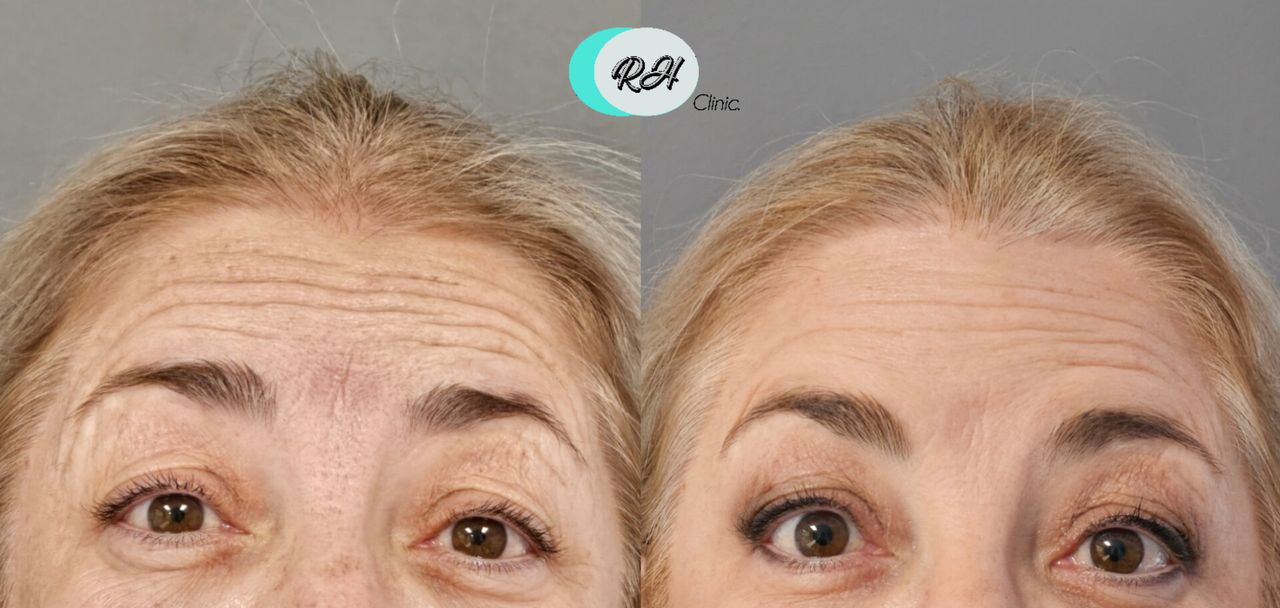 Rosalba Herrero Zerpa-599