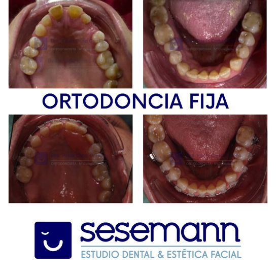 Paula Cano Carrillo-91