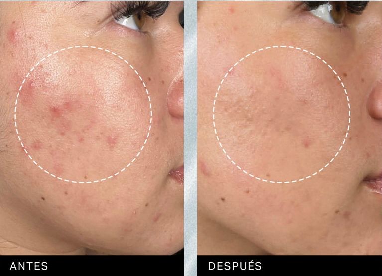 Alba Rubiño Estabén-3