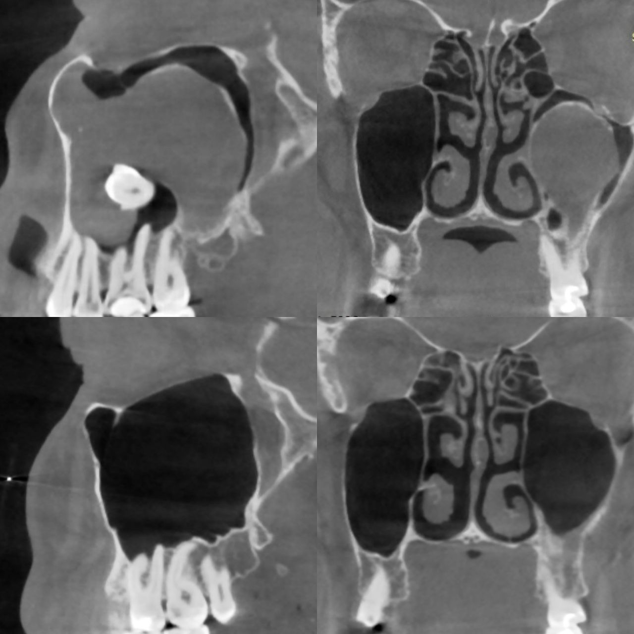 Paweł Poniatowski-20