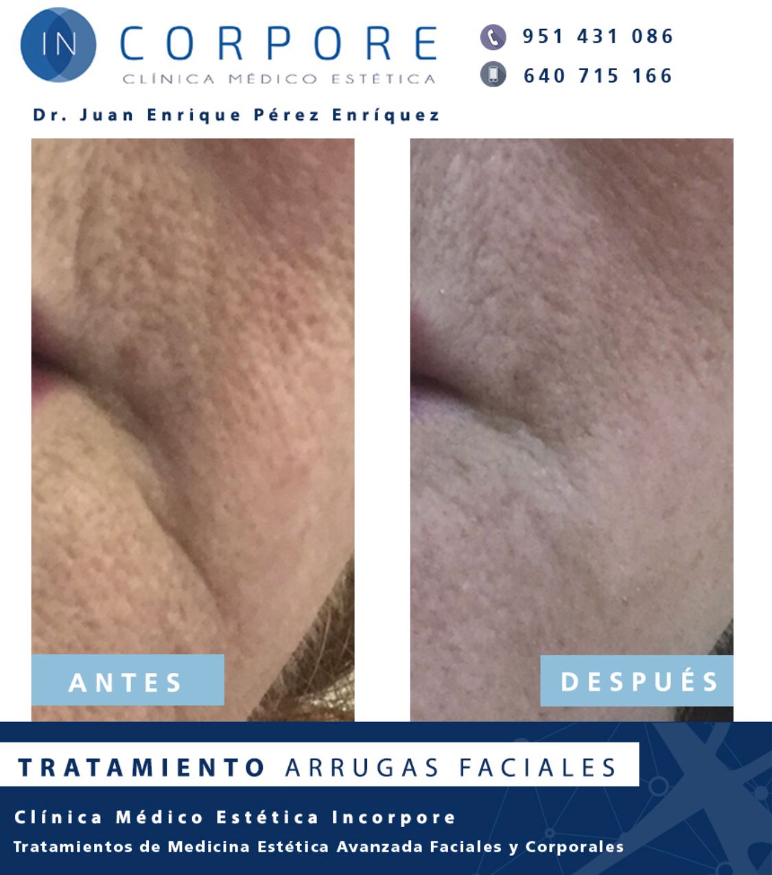 Juan Enrique Pérez Enríquez-100