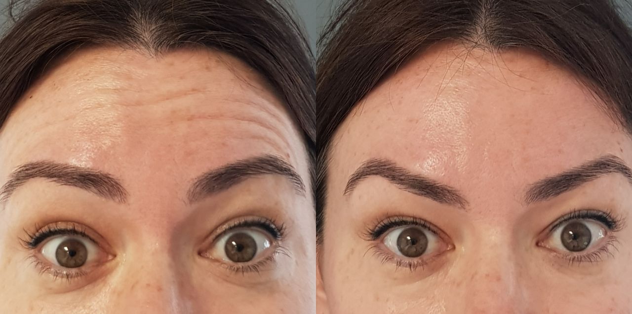 Rosalba Herrero Zerpa-493