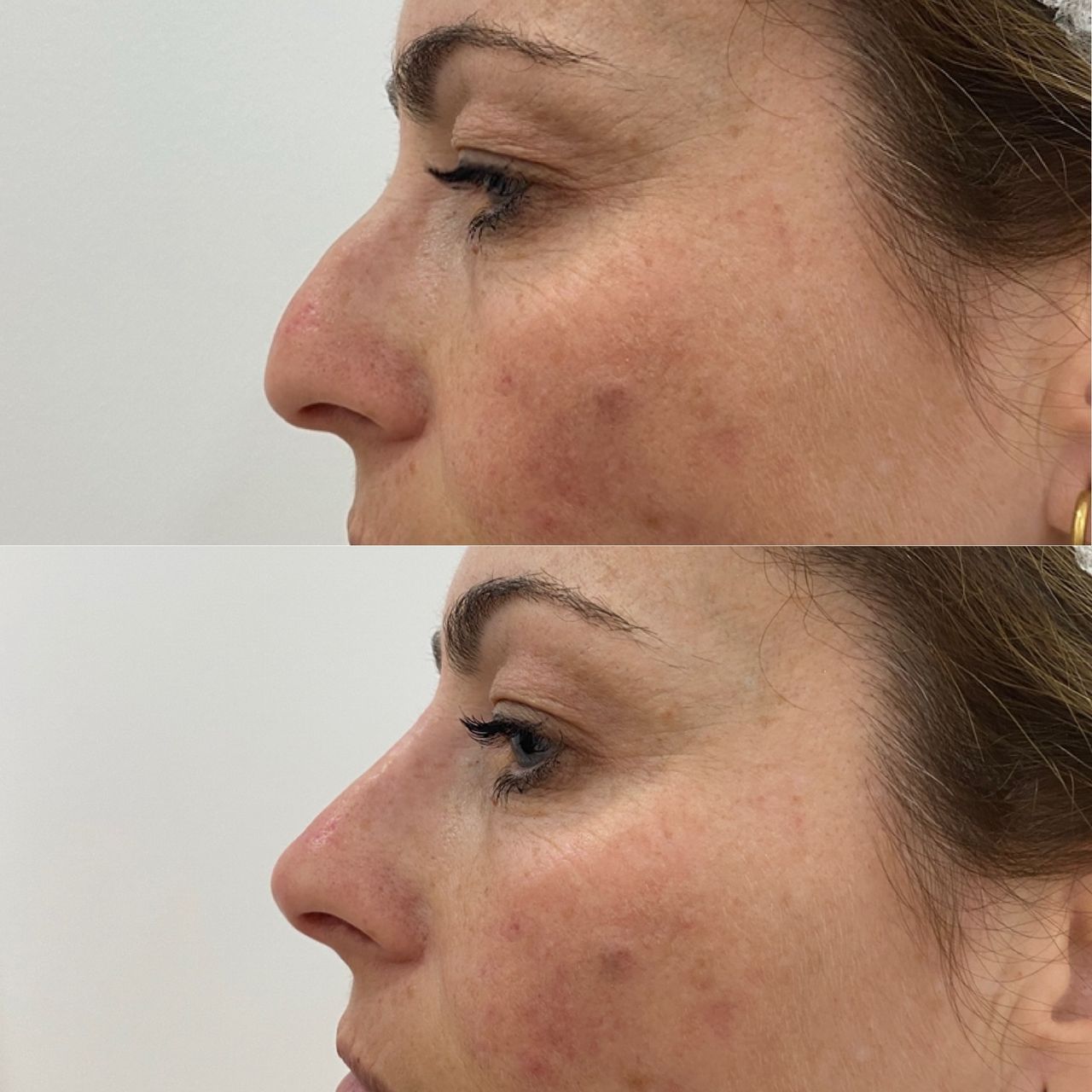 Raffaele Del Prete-11