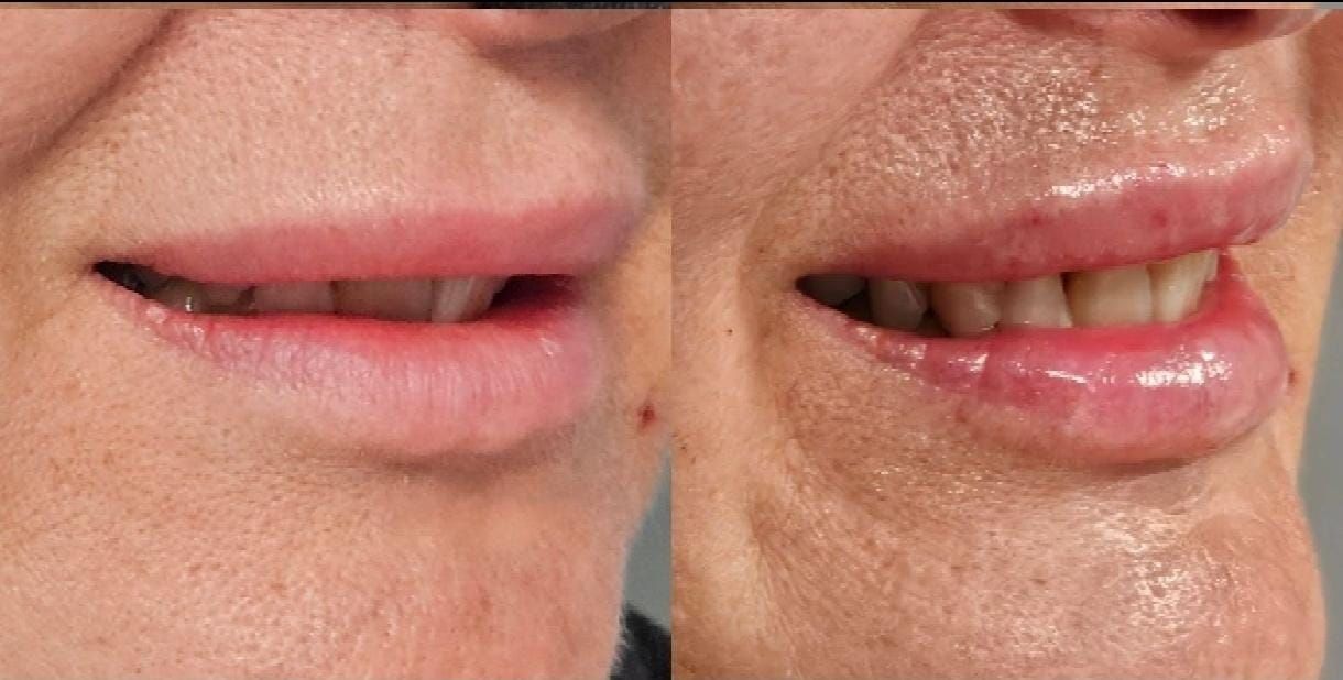 Rosalba Herrero Zerpa-531