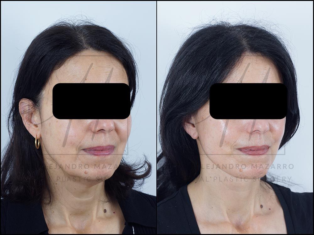 Alejandro Mazarro Campos-1