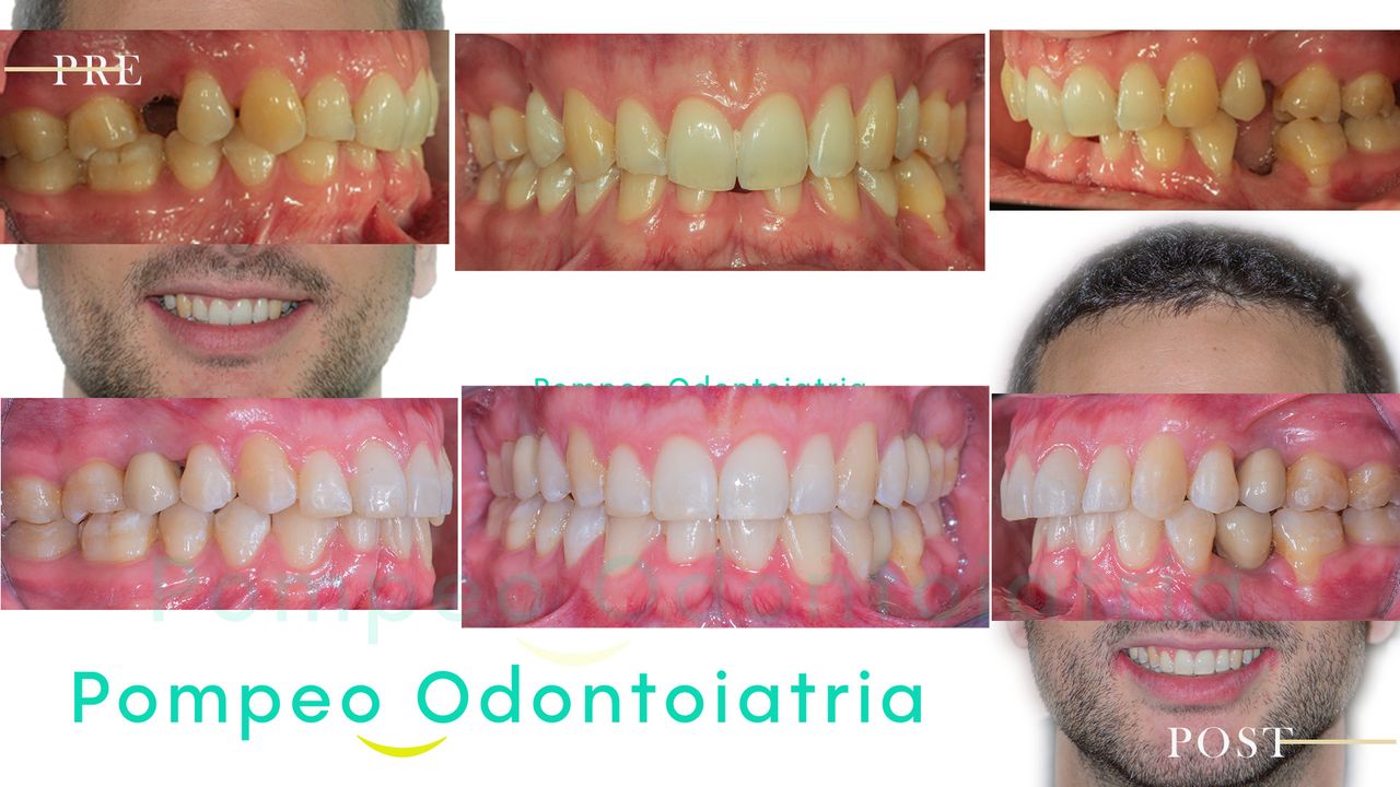 Enrico Maria Pompeo-2