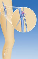 Domenico Di Crisci-6