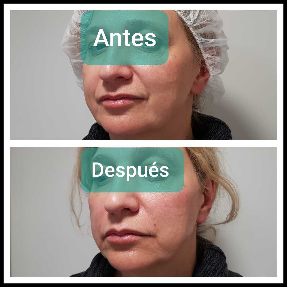 Rosalba Herrero Zerpa-344