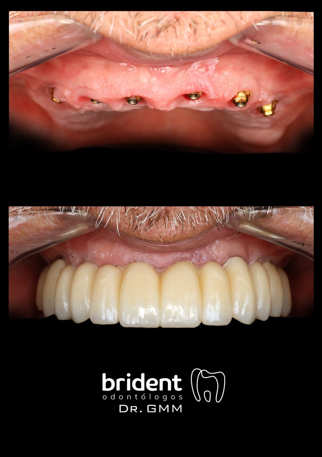 Guillermo Moreno Fragoso-49