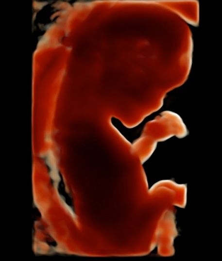 Tommaso Incandela-19