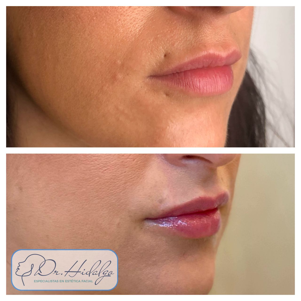 Víctor Hidalgo López-3