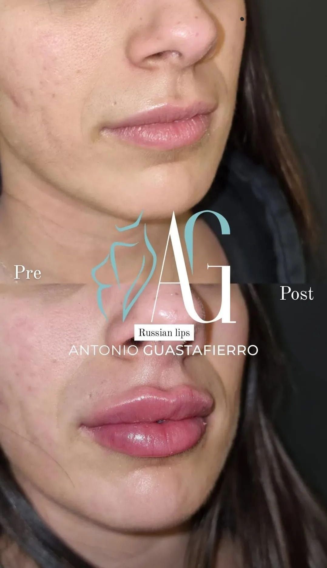 Antonio Guastafierro-12