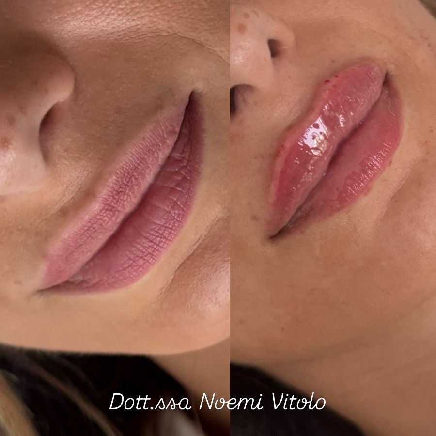 Noemi  Vitolo-5