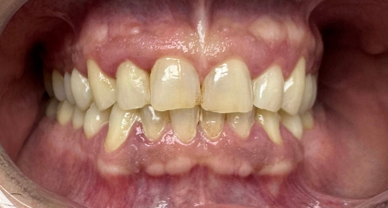 César Buján Riveiro-8