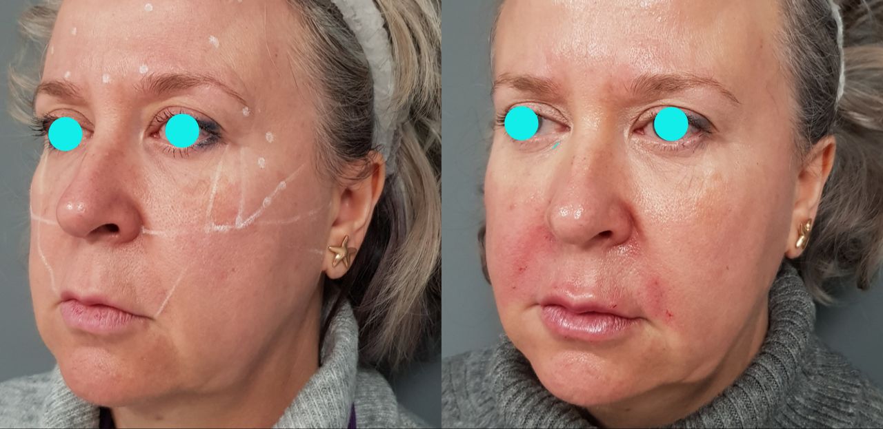 Rosalba Herrero Zerpa-124