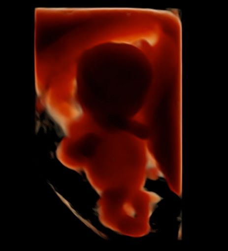 Tommaso Incandela-14