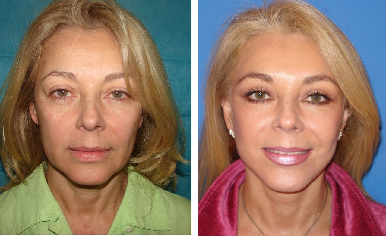 Jaime Eduardo Chacón Hernández-12