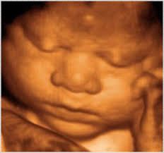 Aparicio Zanon Serrano-2