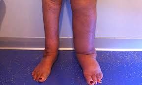 Mario De Laurentis-16