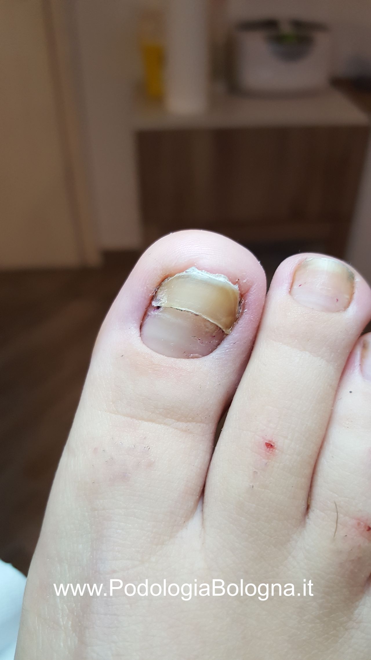 Lorenzo Fasanelli Menestrina-8