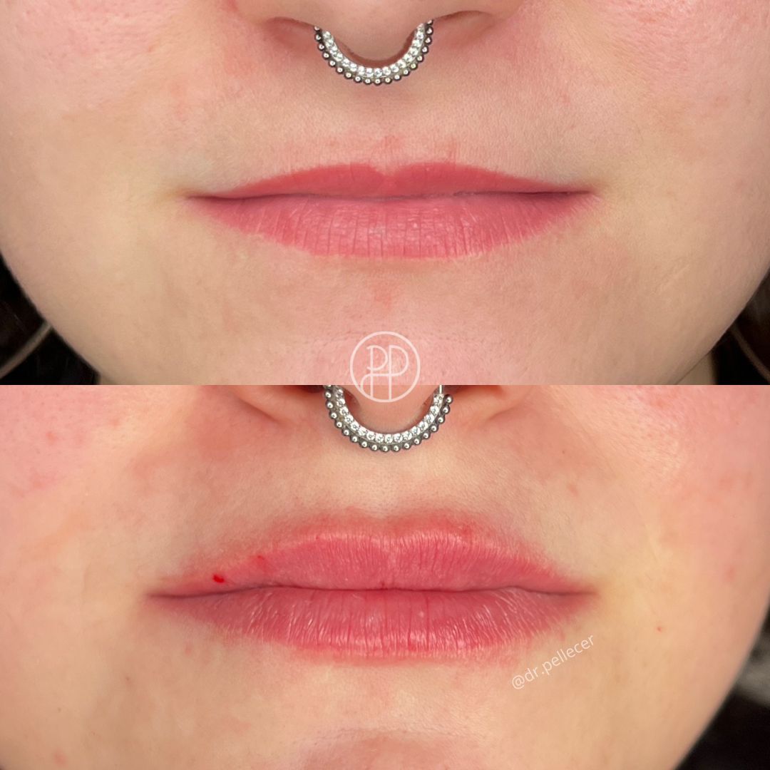 Liliana Paola Pellecer Ruiz-1