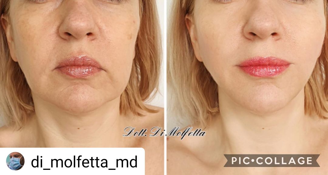 Pasquale Di Molfetta-18