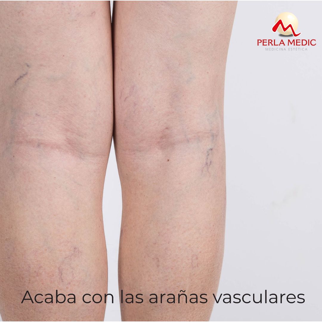 Sara Gomis Lledo-3