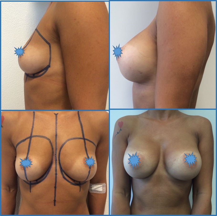 Giorgio Giovannelli-14