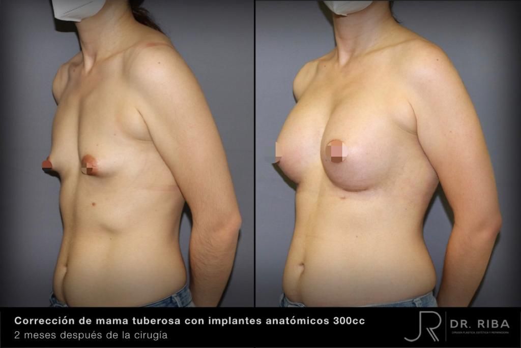 Jordi Riba Vilchez-11