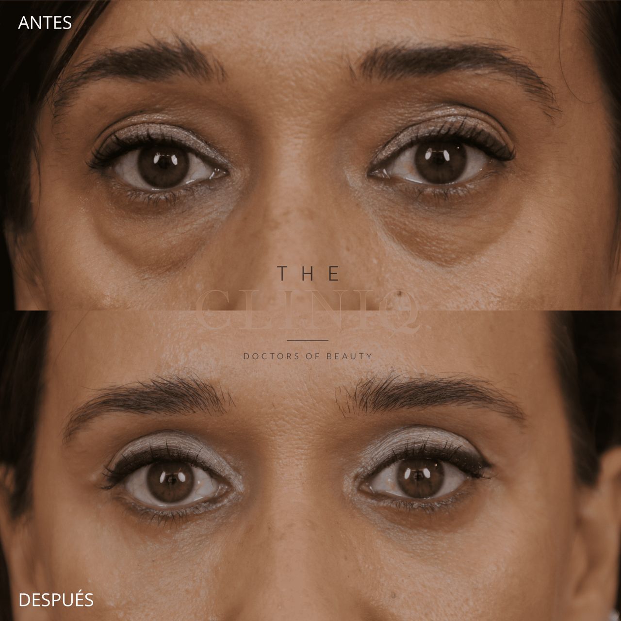 Ignacio Genol Saavedra-8