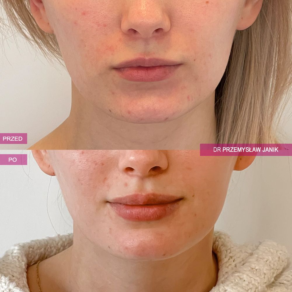 Przemysław Janik-48