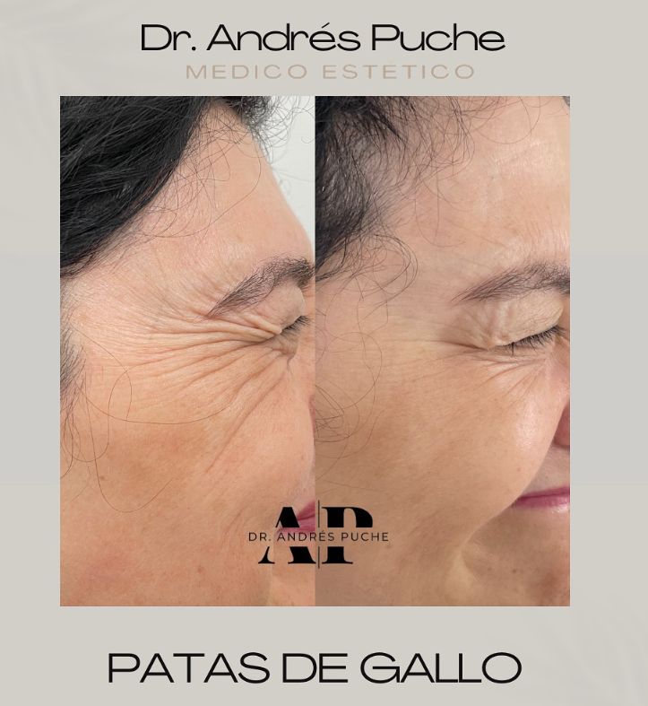 Andrés Puche Urdaneta-0