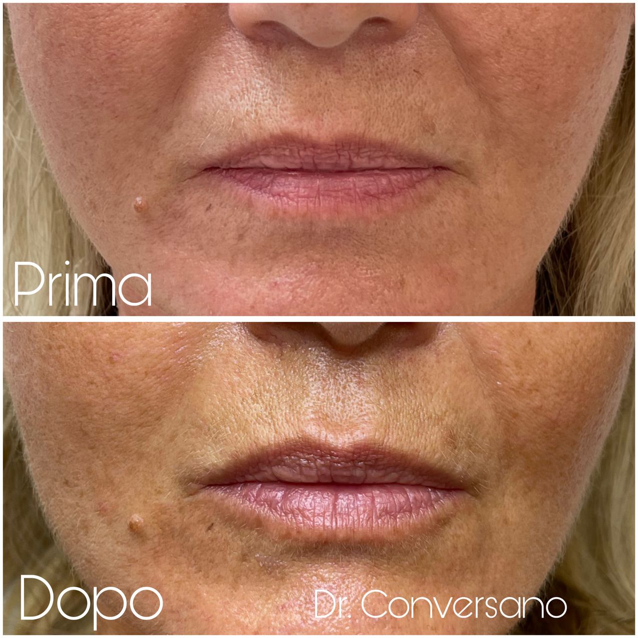 Sergio Conversano-29