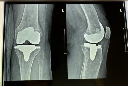 Valerio Cipolloni-10