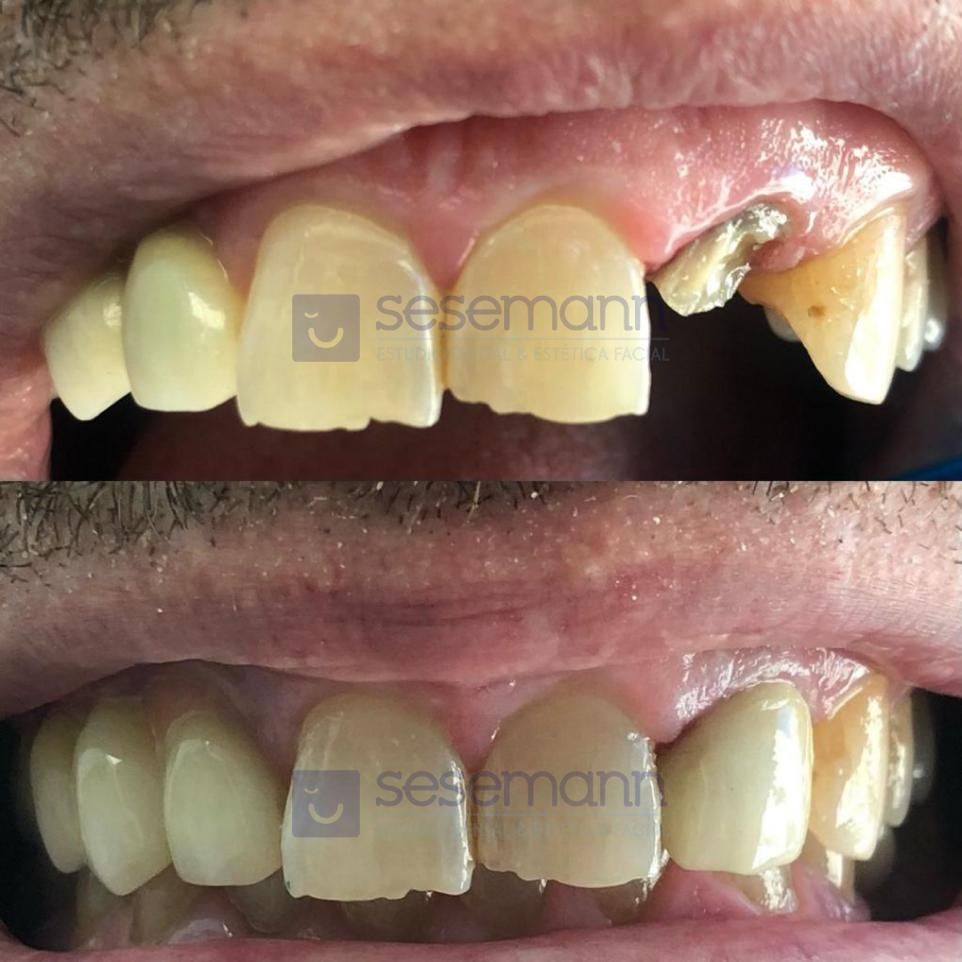 Paula Cano Carrillo-53