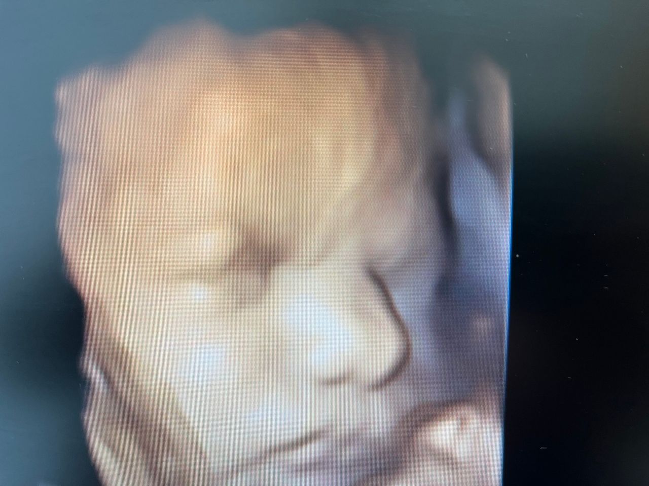 Jose Santiago-Cuadri Artacho-3