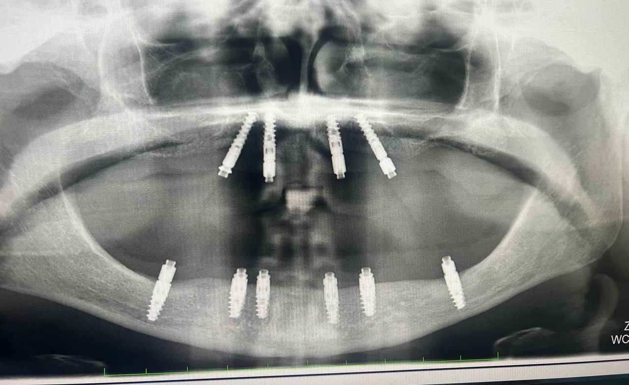 Luigi Aiardo Esposito-19