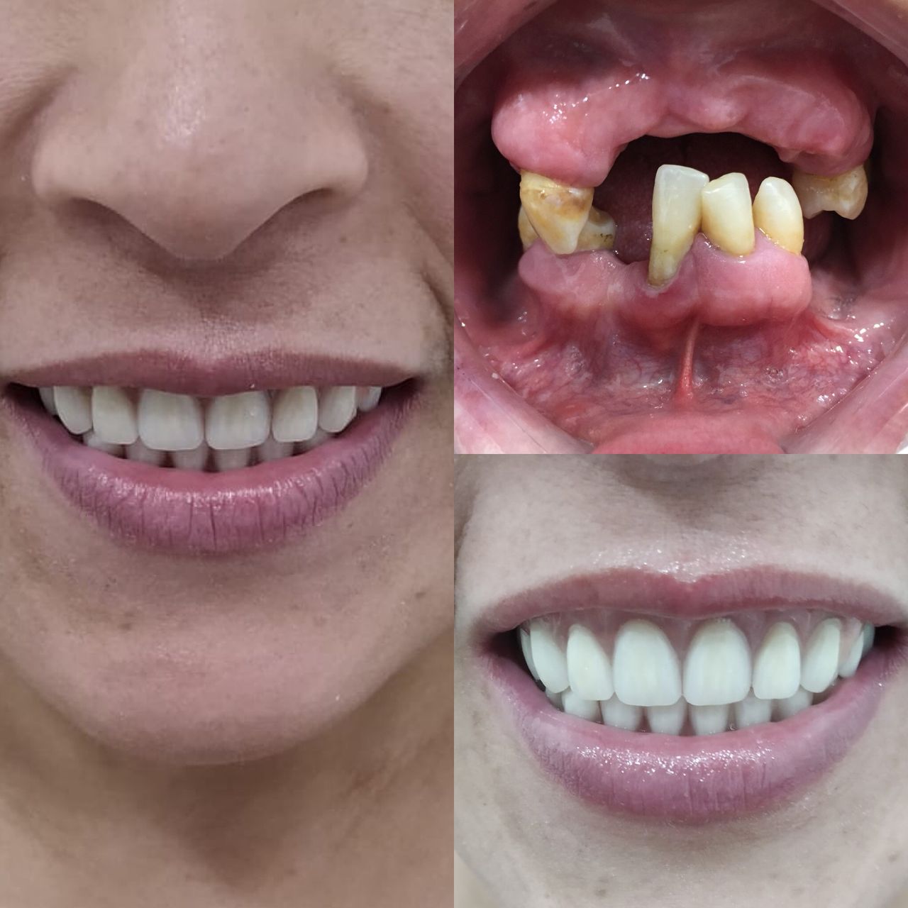 Antonia Aviles Lopez-55