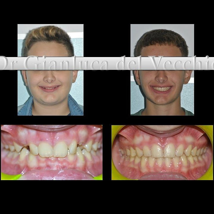 Gianluca Del Vecchio-48