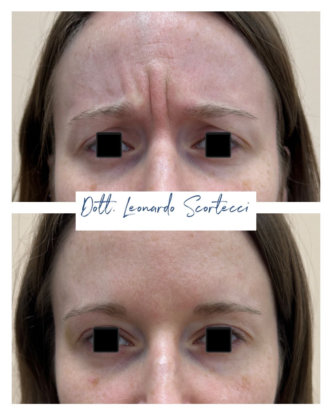 Leonardo Scortecci-22