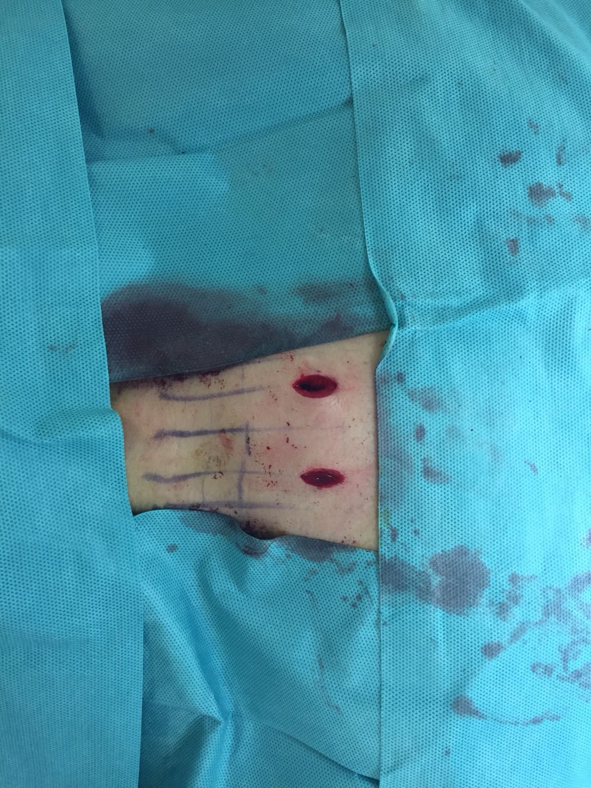 Juan Camilo Hernandez Acevedo-30