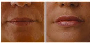 Paolo Bastianelli-35