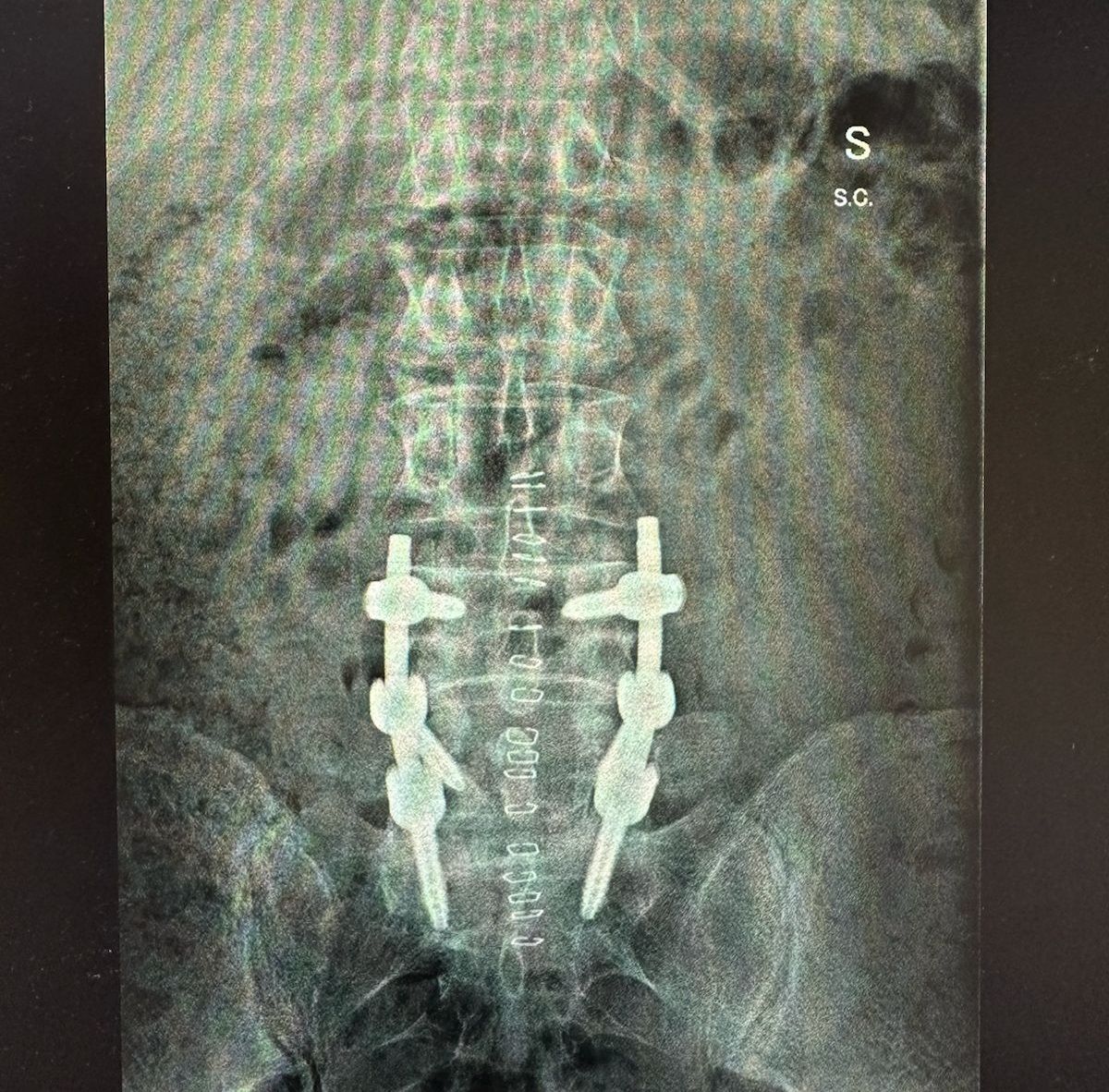 Valerio Cipolloni-27