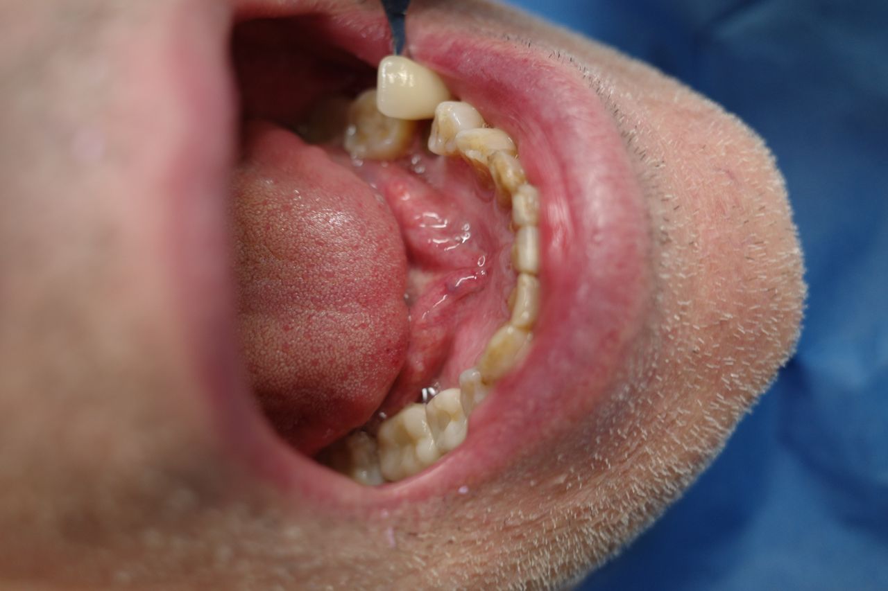 Gianluigi Bittante-93