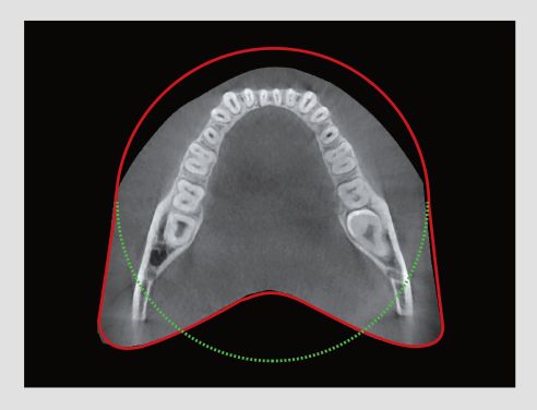 Tac Dental 3D Cbct-5