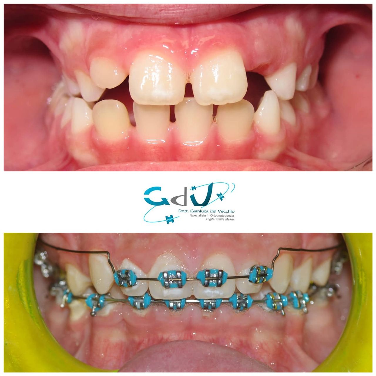 Gianluca Del Vecchio-94