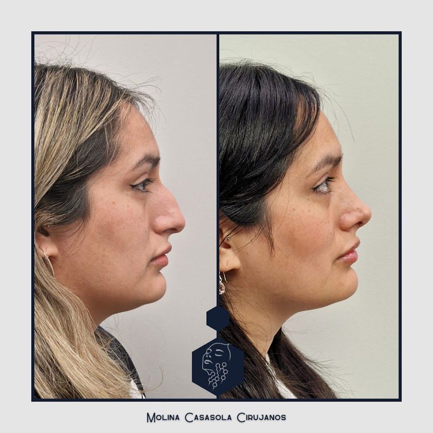 Sandra Marleny Casasola Girón-4