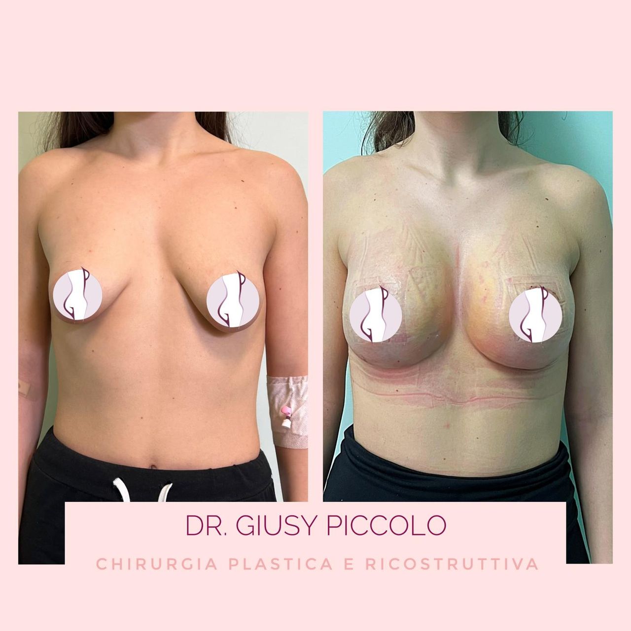 Giuseppina Piccolo-8