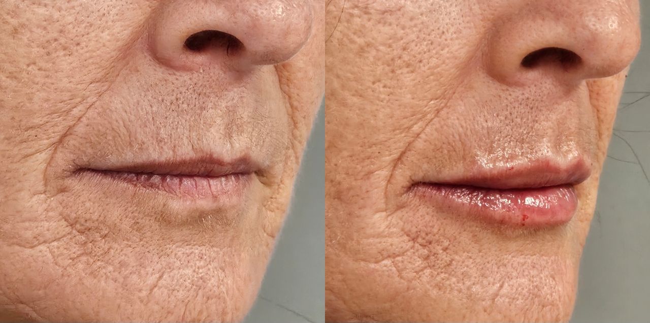 Rosalba Herrero Zerpa-571